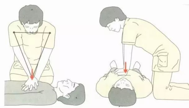 徒手心肺复苏操作要点